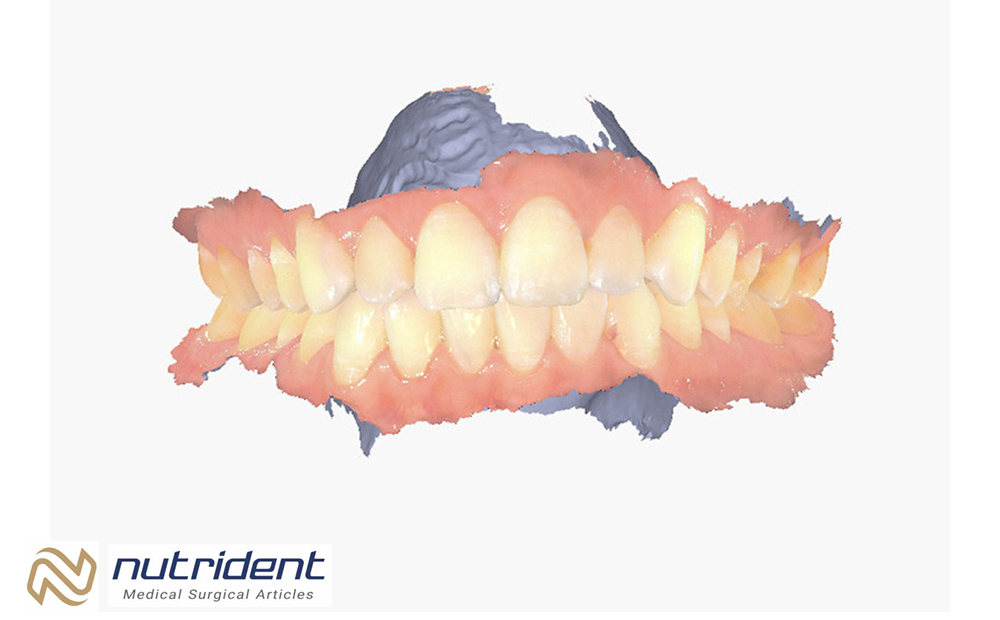 Fast and Accurate Full-Arch Scanning