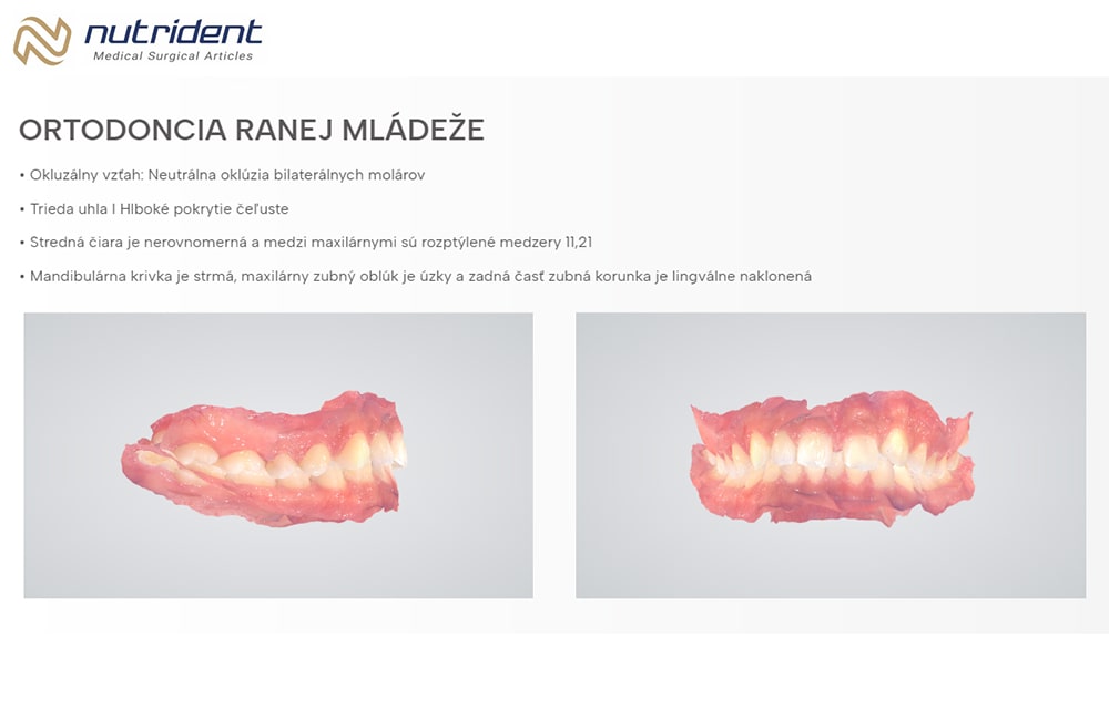 Advanced Technology for Digital Dentistry