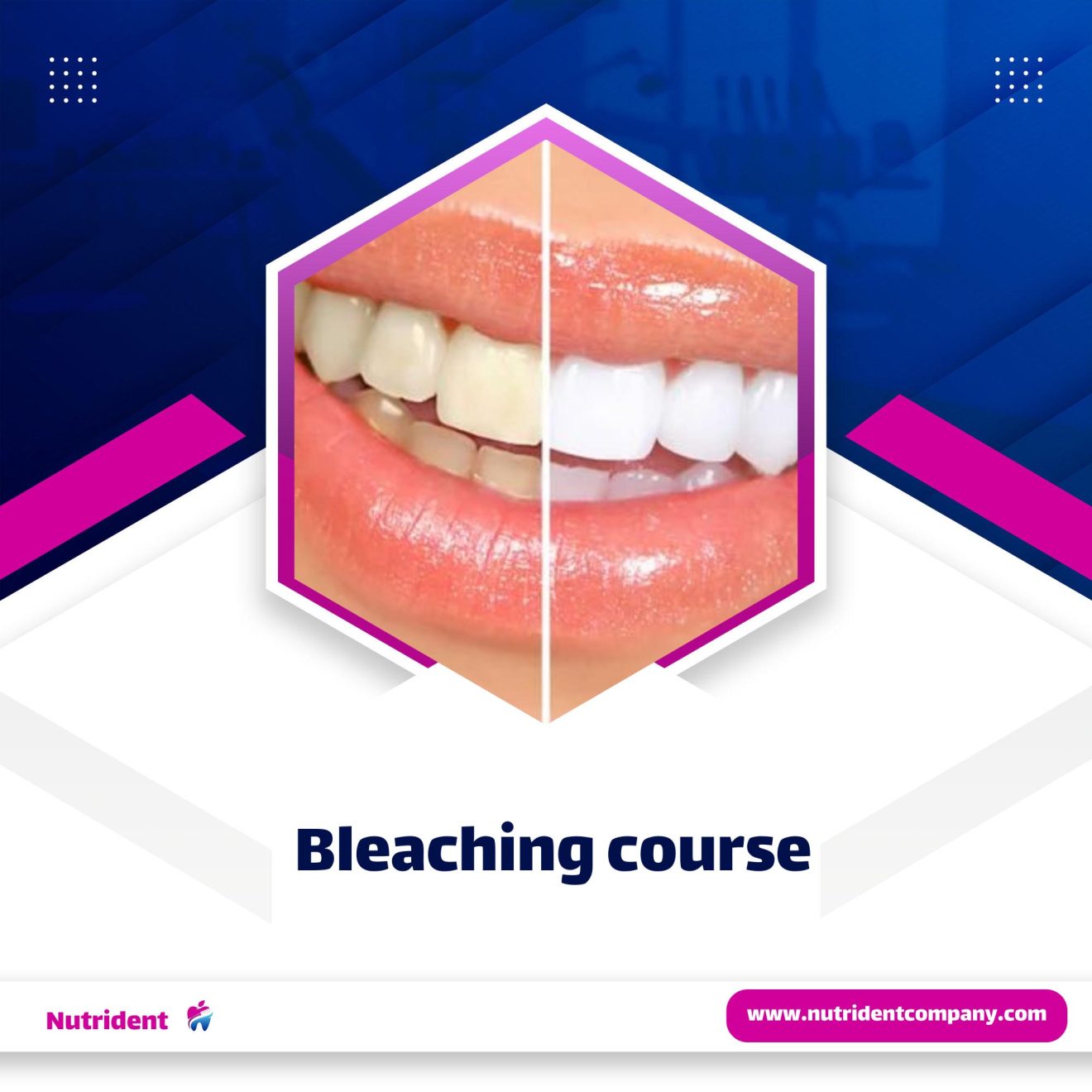 Bleaching course - Nutrident